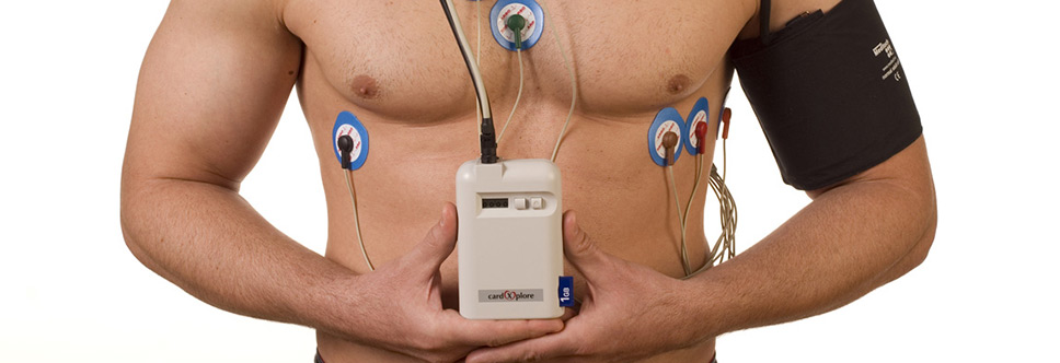 ekg